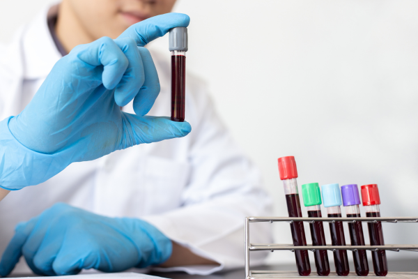 Fetal Blood Sampling (1)