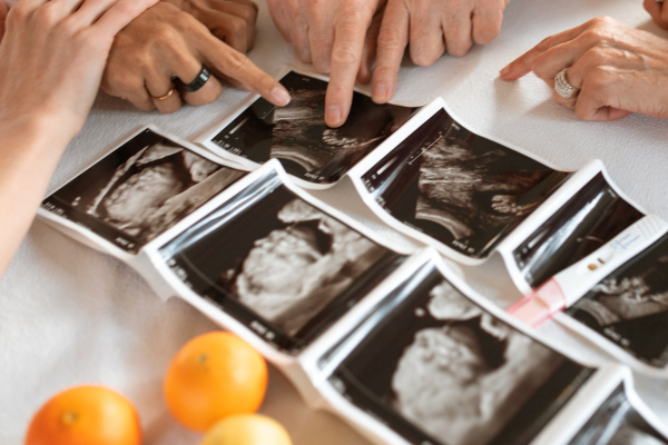 Fetal Echocardiography